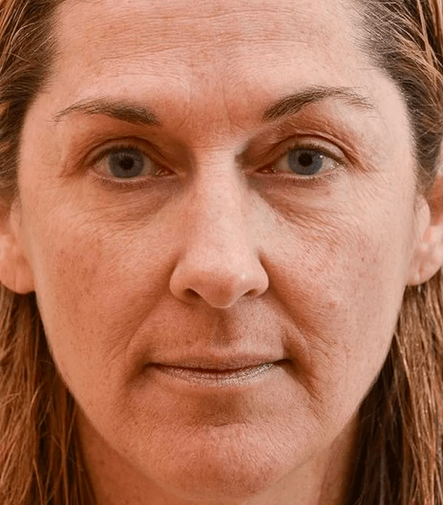 Mon visage avant d'utiliser Eudalie -cream