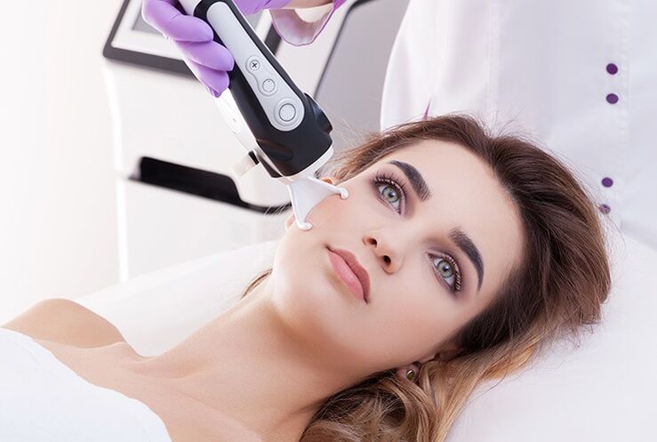 Rajeunissement au laser