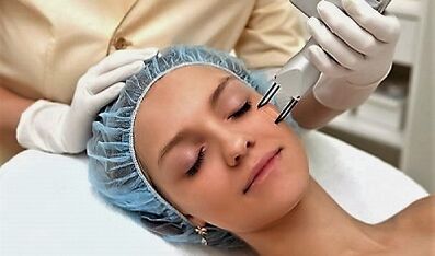 Procédure de rajeunissement de la peau du visage